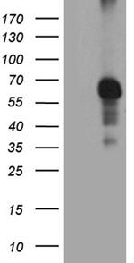 RIPK3 Antibody in Western Blot (WB)