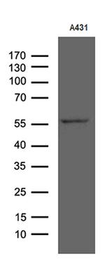 RIPK3 Antibody in Western Blot (WB)