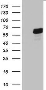 RIPK3 Antibody in Western Blot (WB)