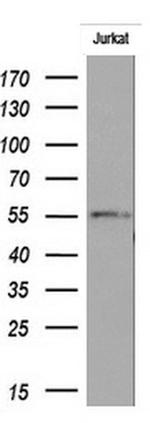 RIPK3 Antibody in Western Blot (WB)