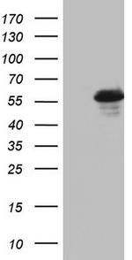 RIPK3 Antibody in Western Blot (WB)