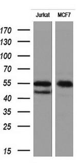 RIPK3 Antibody in Western Blot (WB)