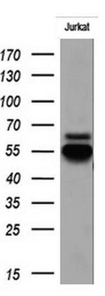 RIPK3 Antibody in Western Blot (WB)