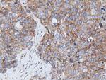 RIT2 Antibody in Immunohistochemistry (Paraffin) (IHC (P))