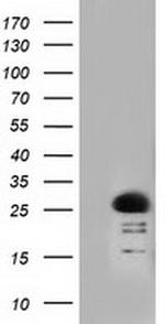 RIT2 Antibody in Western Blot (WB)