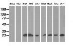 RIT2 Antibody in Western Blot (WB)