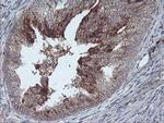 RLBP1 Antibody in Immunohistochemistry (Paraffin) (IHC (P))