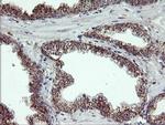 RLBP1 Antibody in Immunohistochemistry (Paraffin) (IHC (P))