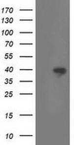 RLBP1 Antibody in Western Blot (WB)