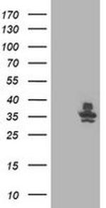 RLBP1 Antibody in Western Blot (WB)