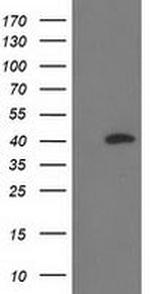 RLBP1 Antibody in Western Blot (WB)