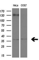 RLBP1 Antibody in Western Blot (WB)