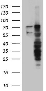 RLIM Antibody in Western Blot (WB)