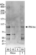 RN-tre Antibody in Western Blot (WB)