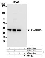 RNASEH2A Antibody in Western Blot (WB)