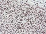 RNF113B Antibody in Immunohistochemistry (Paraffin) (IHC (P))