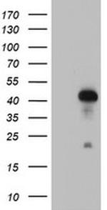 RNF113B Antibody in Western Blot (WB)