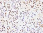 RNF138 Antibody in Immunohistochemistry (IHC)