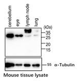 RNF138 Antibody in Western Blot (WB)