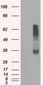 RNF144B Antibody in Western Blot (WB)