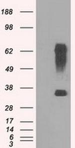 RNF144B Antibody in Western Blot (WB)