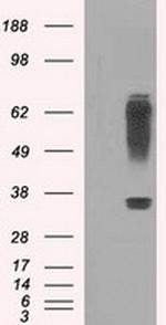RNF144B Antibody in Western Blot (WB)