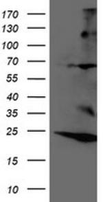 RNF144B Antibody in Western Blot (WB)