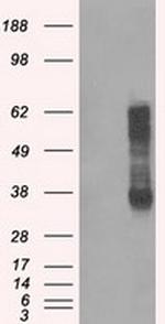 RNF144B Antibody in Western Blot (WB)