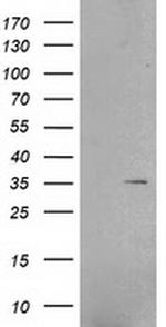 RNF144B Antibody in Western Blot (WB)