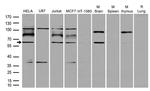 RNF168 Antibody in Western Blot (WB)