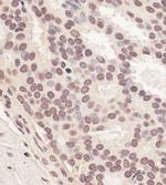 RNF2 Antibody in Immunohistochemistry (IHC)