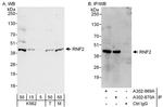 RNF2 Antibody in Western Blot (WB)