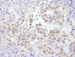 RNF20 Antibody in Immunohistochemistry (IHC)