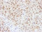 RNF20 Antibody in Immunohistochemistry (IHC)