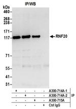 RNF20 Antibody in Western Blot (WB)