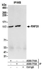 RNF20 Antibody in Western Blot (WB)