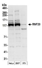 RNF20 Antibody in Western Blot (WB)