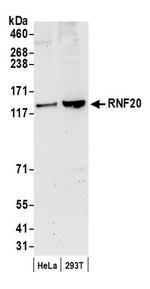 RNF20 Antibody in Western Blot (WB)