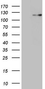 RNF20 Antibody in Western Blot (WB)