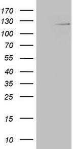 RNF20 Antibody in Western Blot (WB)