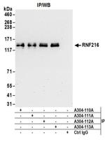 RNF216 Antibody in Western Blot (WB)
