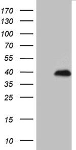 RNF4 Antibody in Western Blot (WB)