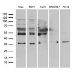 RNF4 Antibody in Western Blot (WB)