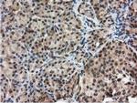 RNH1 Antibody in Immunohistochemistry (Paraffin) (IHC (P))