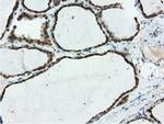 RNH1 Antibody in Immunohistochemistry (Paraffin) (IHC (P))