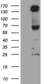 ROBO4 Antibody in Western Blot (WB)