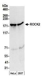 ROCK2 Antibody in Western Blot (WB)