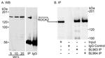 ROCK2 Antibody in Western Blot (WB)