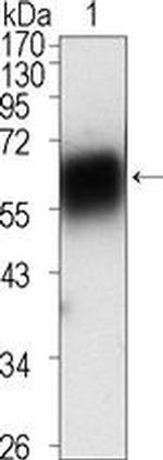 ROR1 Antibody in Western Blot (WB)