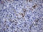 ROR2 Antibody in Immunohistochemistry (Paraffin) (IHC (P))